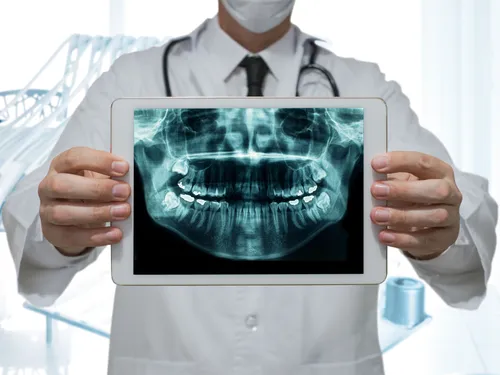 Benefits of digital scanning
