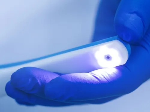 Intraoral camera at Desoto Dentures and Implants