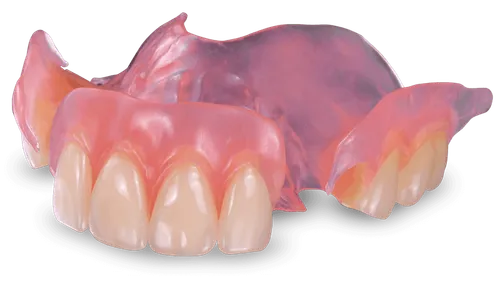 Partial denture example at Desoto Dentures and Implants